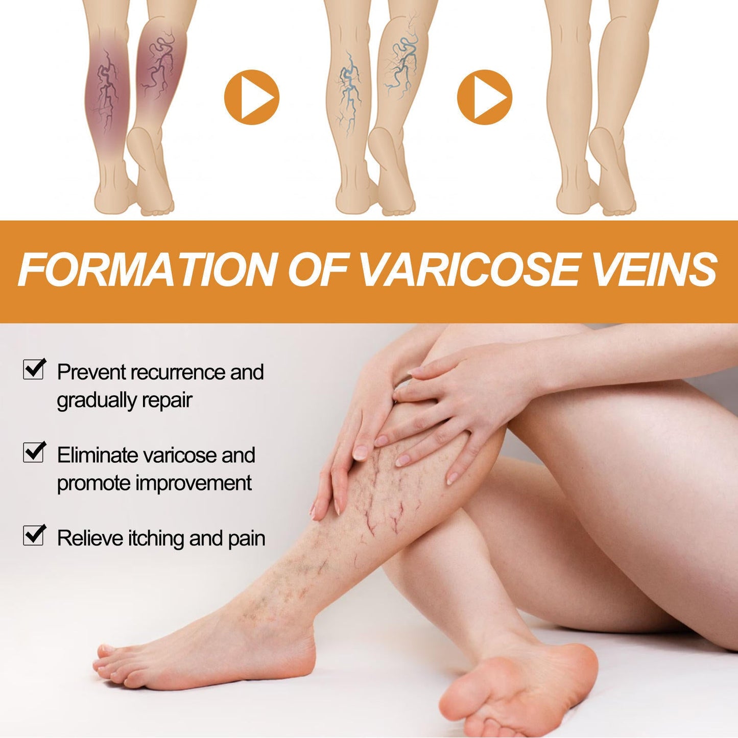 Turmeric Varicose Vein Relief Spray( BUY 1 GET 1 FREE )