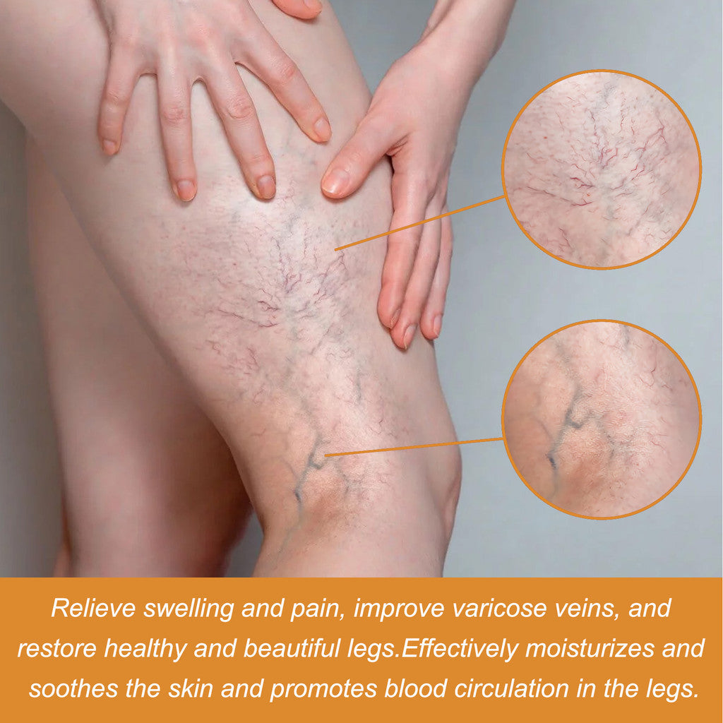 Turmeric Varicose Vein Relief Spray( BUY 1 GET 1 FREE )
